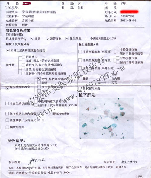 TCT检查结果报告单